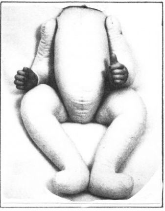 LIJF "Tweeling-baby" 50cm - nr. 1