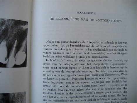 Tandheelkundige monografieen, dr. C.O.Eggink - 3