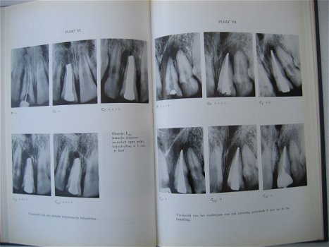 Tandheelkundige monografieen, dr. C.O.Eggink - 4