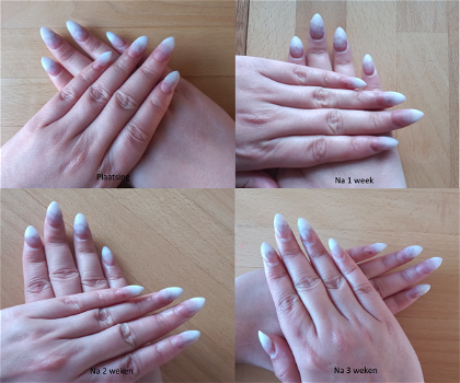 Manicure-, gelnagel-, dipcrylic- en acrylbehandelingen te Groningen - 2