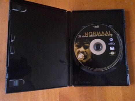 DVD Normaal - Ik Kom Altied Weer Terug - 1