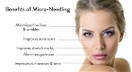 Micro Needling - 2 - Thumbnail