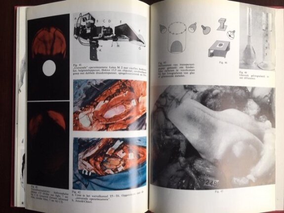 Praktische handleiding vd medische fotografie - Piso - Afbeelding 6