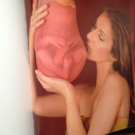 Anne Geddes en Celine Dion - Miracle + DVD - Afbeelding 4