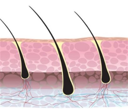 HaarStamcel Transplantatie Behandeling - 0