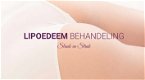 Lipoedeem Liposuctie Behandeling - 0 - Thumbnail