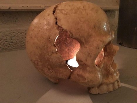 1 anatomische schedel, uit gietijzer-white-rust - 1