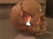 1 anatomische schedel, uit gietijzer-white-rust - 1 - Thumbnail
