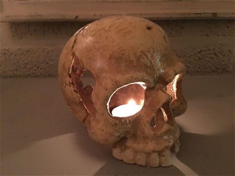1 anatomische schedel, uit gietijzer-white-rust - 3