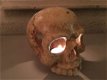 1 anatomische schedel, uit gietijzer-white-rust - 3 - Thumbnail