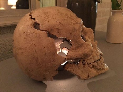 1 grote anatomische schedel,gietijzer-white-rust-schedel - 3
