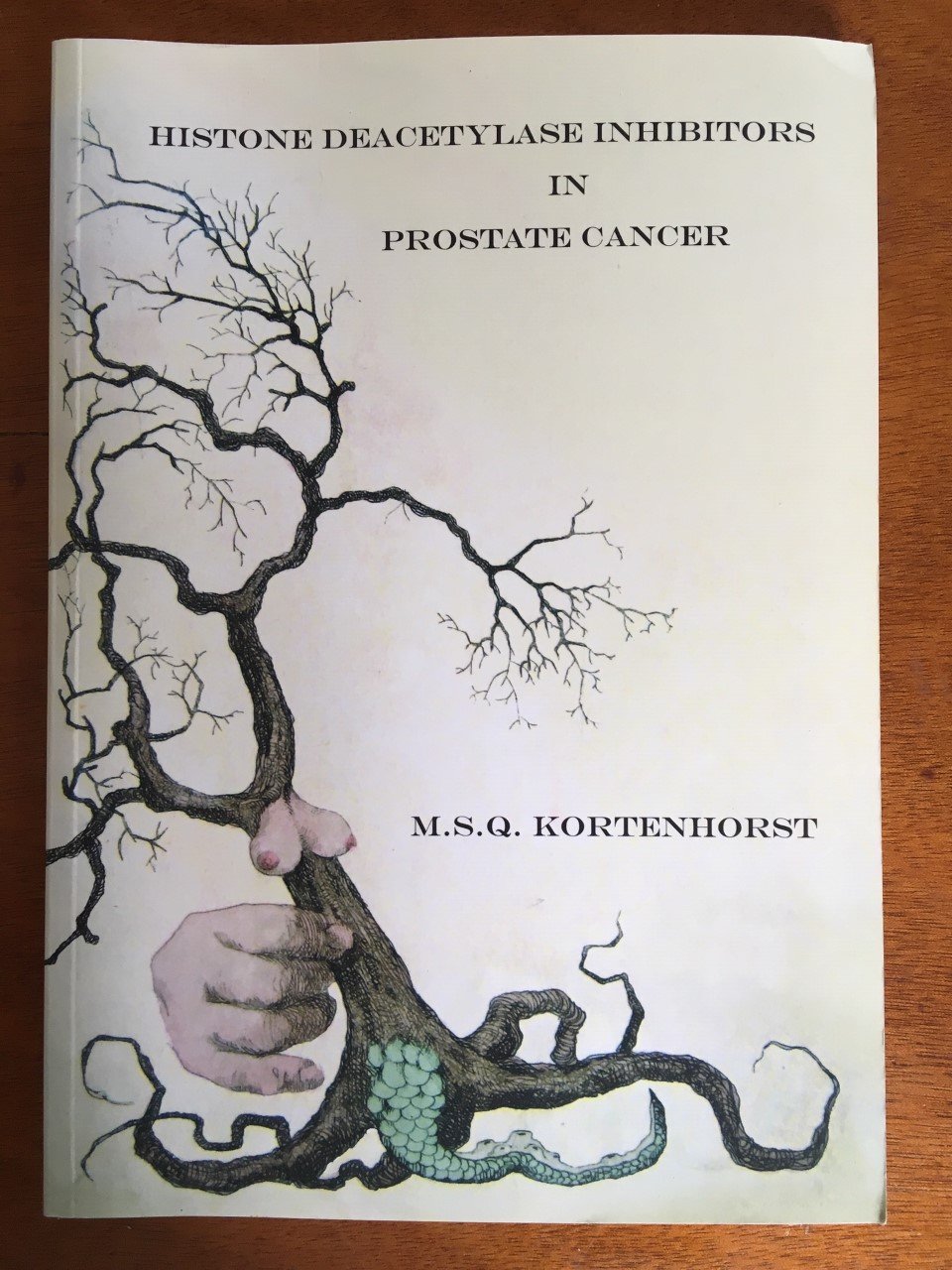 Histone deacetylase inhibitors in prostate cancer - M.S.Q. Kortenhorst - nr. 1