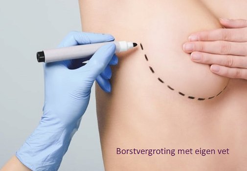 Borstvergroting met eigen vet - 0