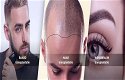 Beste Haartransplantatie Nederland - 0 - Thumbnail