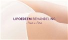 Lipoedeem liposuctie behandeling - 0 - Thumbnail