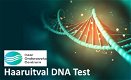 Haaruitval DNA Test - 0 - Thumbnail