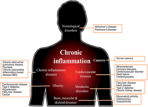 ONTSTEKINGEN-DEMENTIE-ALTZHEIMER-MYOCARDITIS-HERSENEN - 2