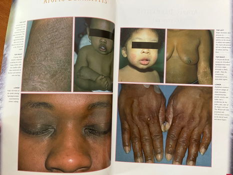 Dermatological atlas of black skin - Connolly, Bikowski - 4