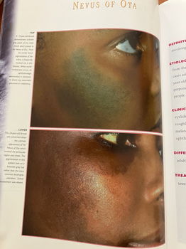 Dermatological atlas of black skin - Connolly, Bikowski - 5